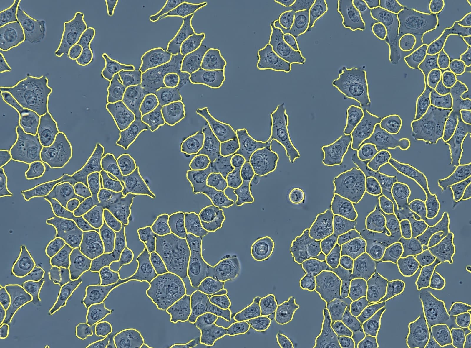 Brightfield HEK293T image with per-cell segmentation outlines