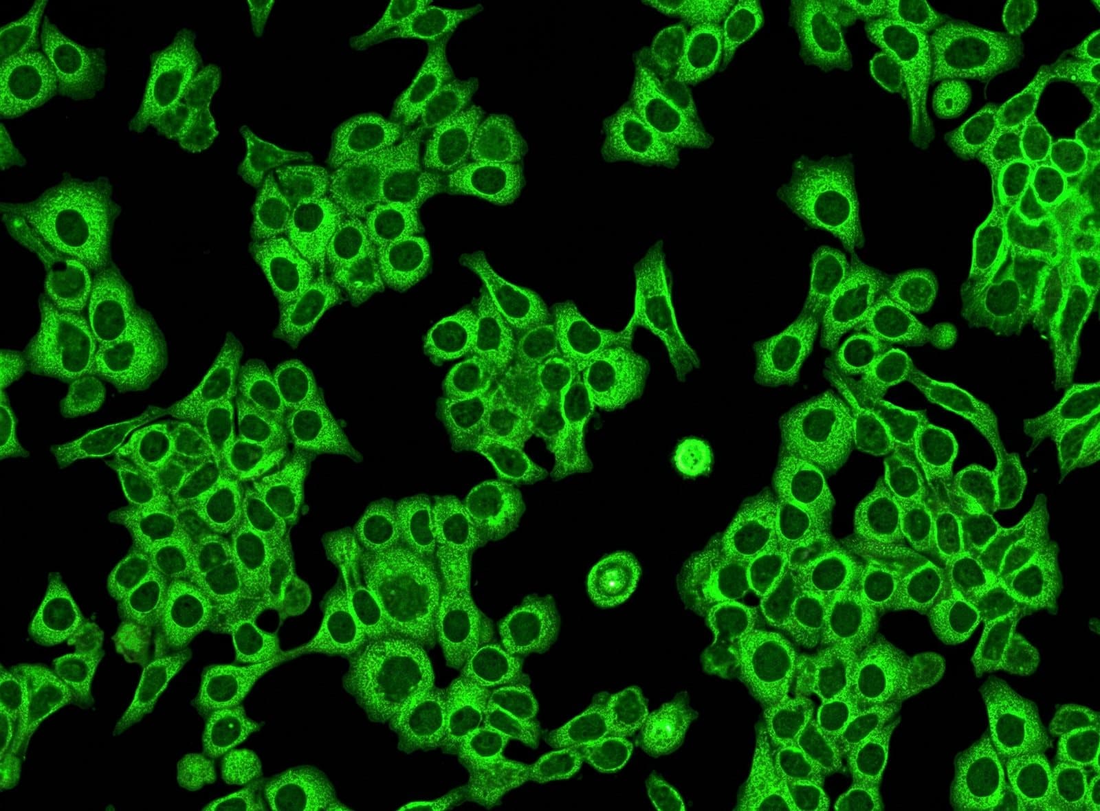 Virtual fluorescence stain predicted from a label-free image