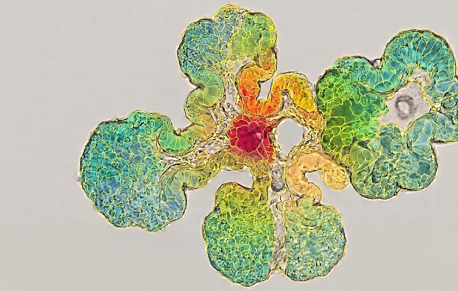 Toxicity heatmap across the retinal organoid