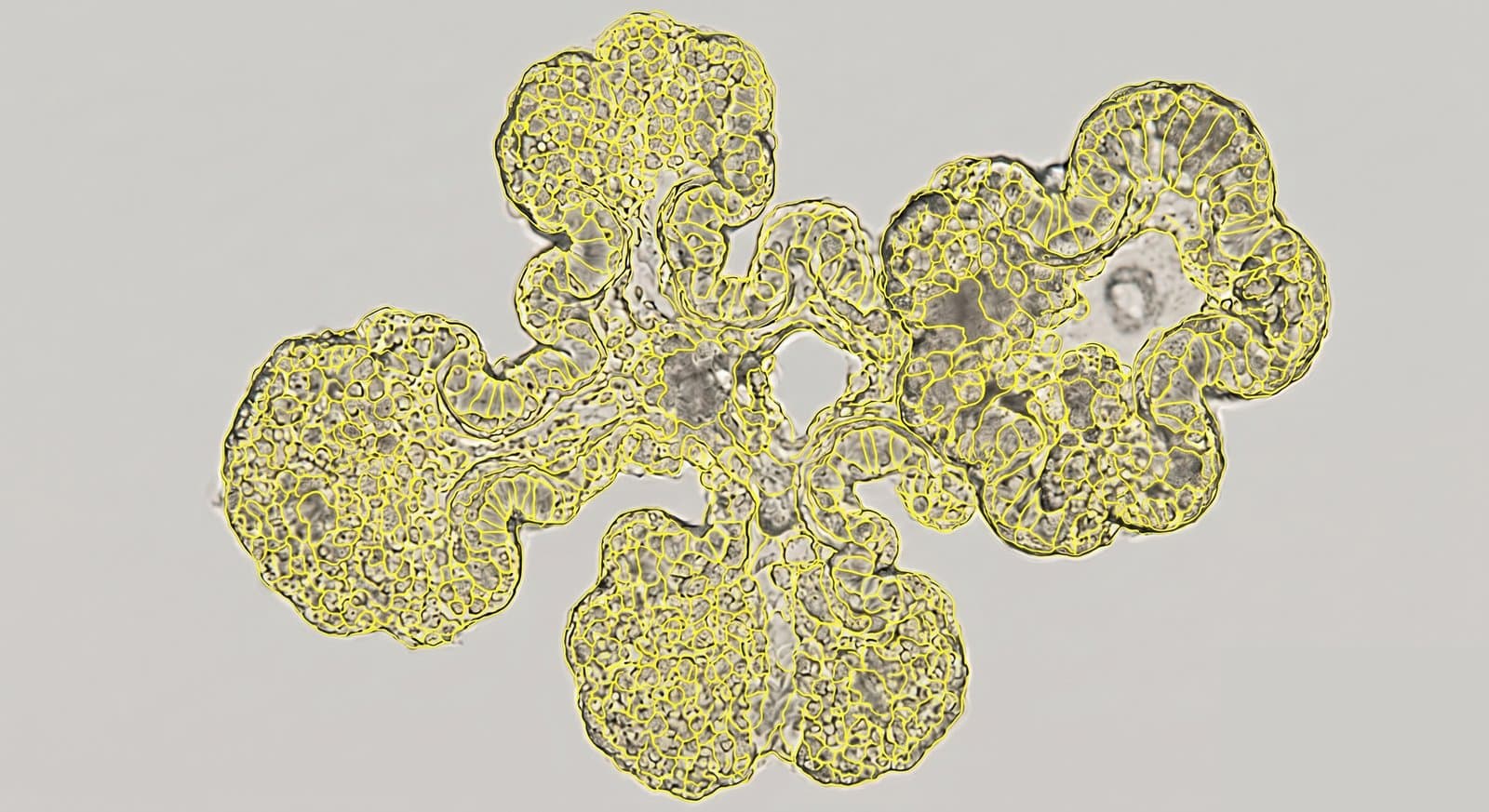 Retinal organoid section with every cell outlined